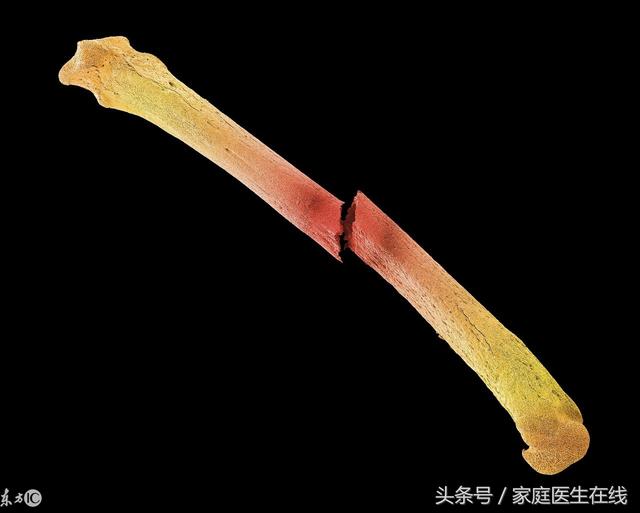 痛风患者可以喝咖啡吗?这些年,咖啡承受的误解实在太多了!